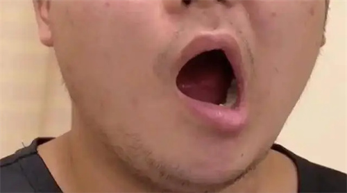 图片细节说明